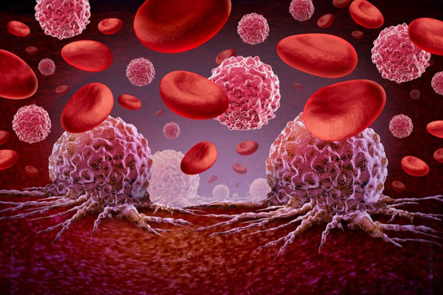 ÇIM PEKA LIVE/ Të gjithë kundër të gjithëve?