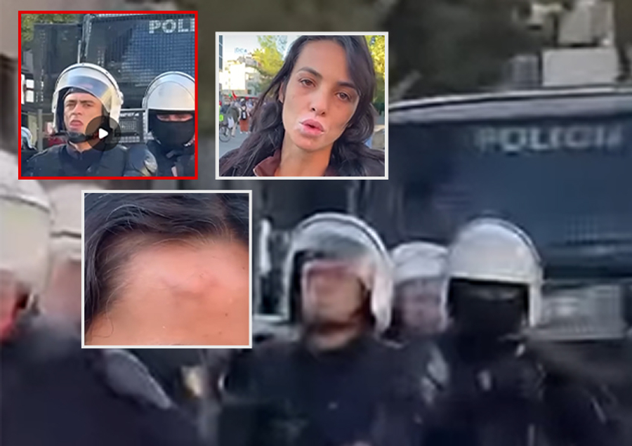  Më dhunuan me shkop gome  ndërkohë që nuk po bëja asgjë   Dëshmia e studentes  Më tërhoqën më futën në  