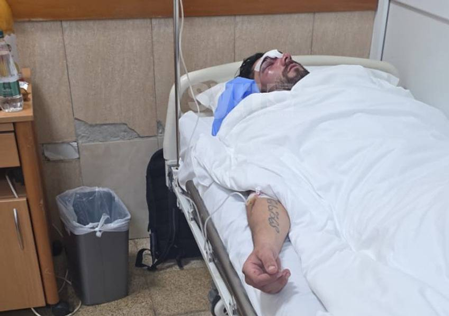 FOTO  Tjetër pamje e rëndë  studenti i masakruar nga policia  në gjendje të rëndë tek Trauma