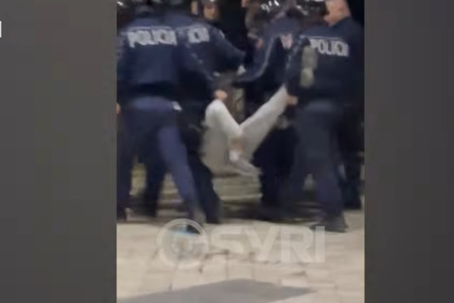 VIDEO  Identifikohet protestuesi që policia i theu këmbën
