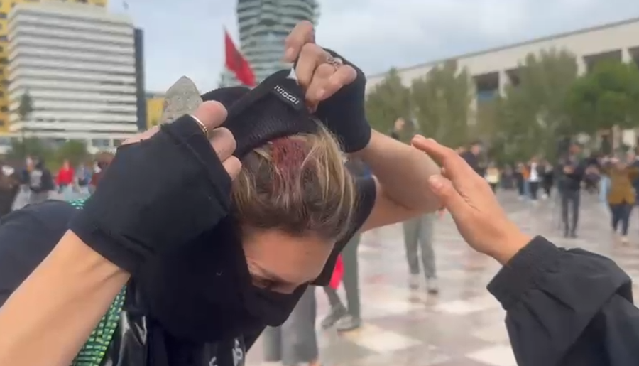 Policia qëllon me gur protestuesen  Vajza e përgjakur tregon plagën