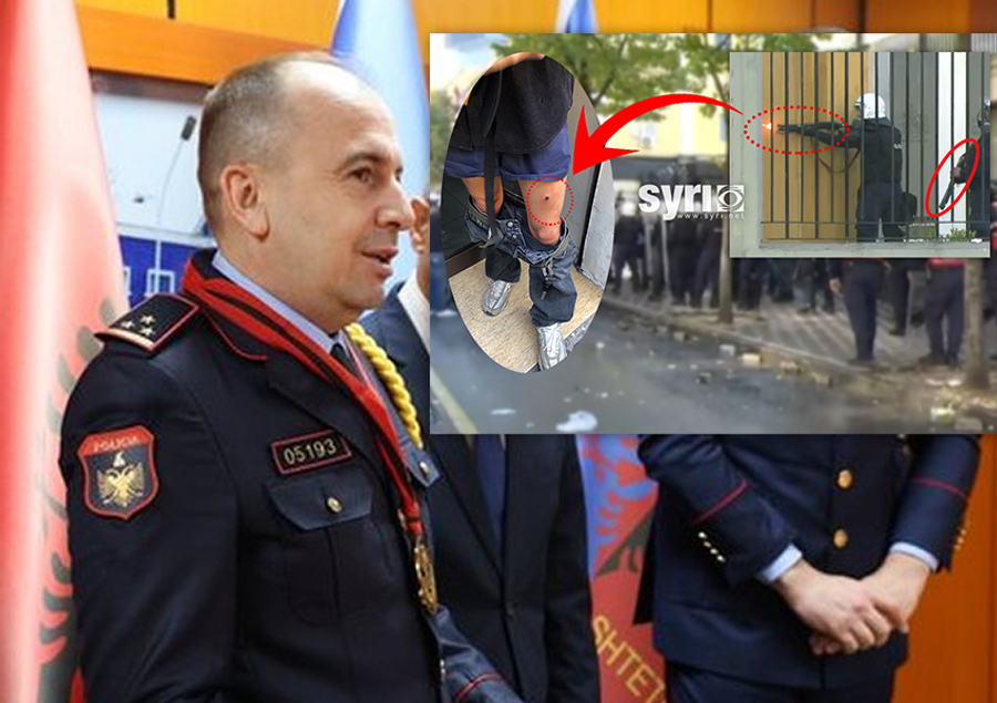 Policia sulmoi me plumba qytetarët: Oliger Torba kyç gojën para gazetarit