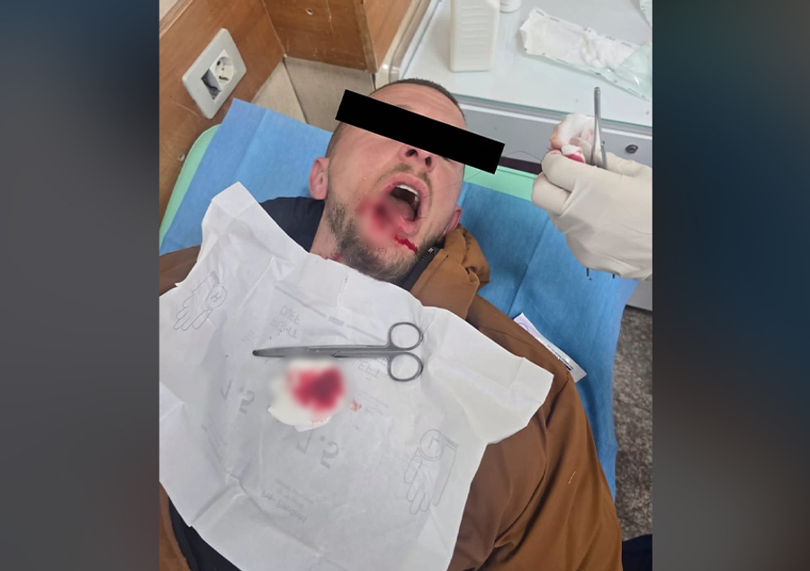  Vrasës mizor stop plumbave mbi studentët  Berisha  Plumb në gojë Leonardit 21 vjeç nga vrasësit e Padrinos