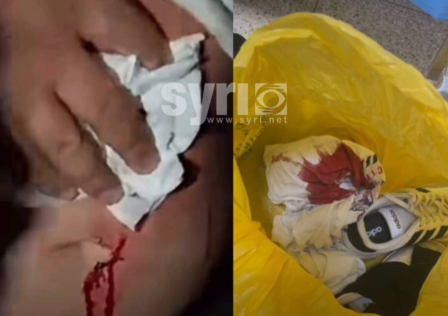 Plagosje me armë zjarri në protestë  Spahia  24 vjeçarit i u nxorrën 2 plumba në formë sferike  thirrje prokurorisë