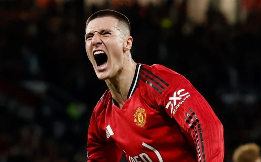 alarm-te-manchester-united-benjamin-sesko-rrezikon-te-mungoje-deri-ne-kater-muaj
