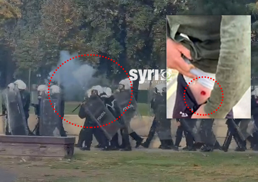 krim-barbar-policia-sulme-masive-me-plumba-dhe-gaz-drejt-protestuesve-paqesor