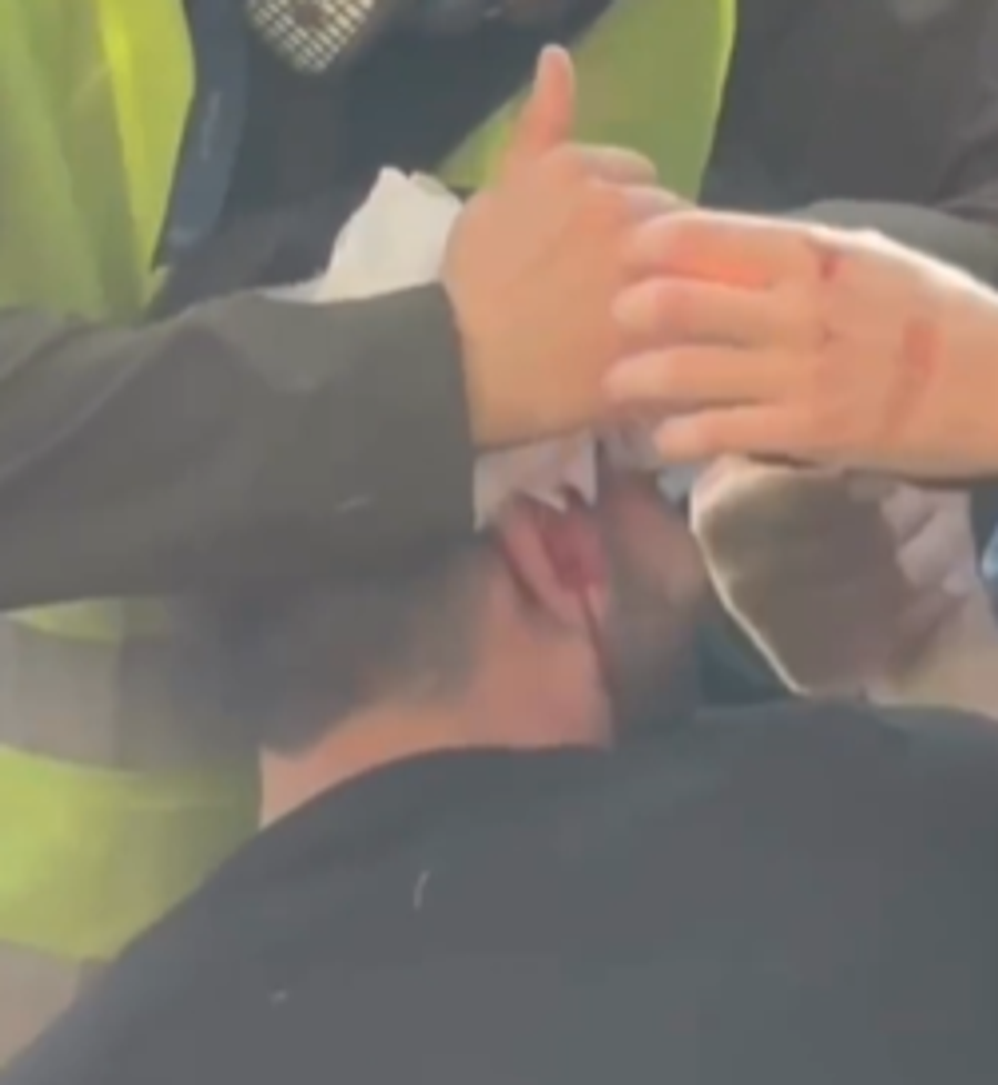 Policia shënjëstron në kokë të riun, e plagos me plumb gome, ‘vullnetarët’ ia fashojnë