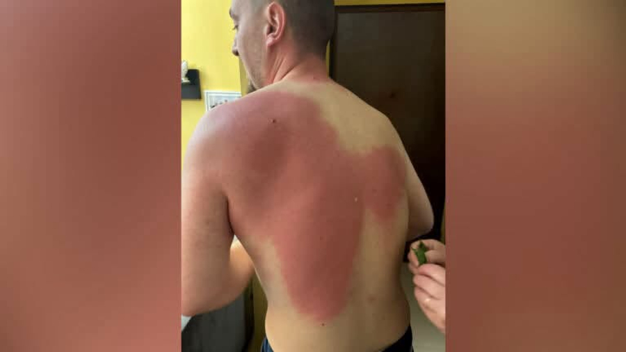 Berisha dënon sulmin ndaj gazetarit Klevin Muka  Atentat ndaj lirisë së mediave