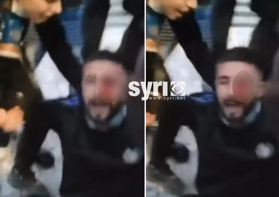 U qëllua nga policia në sy gjatë protestës  I riu pëson hemorragji gjatë ndërhyrjes kirurgjikale  shtyhet operacioni