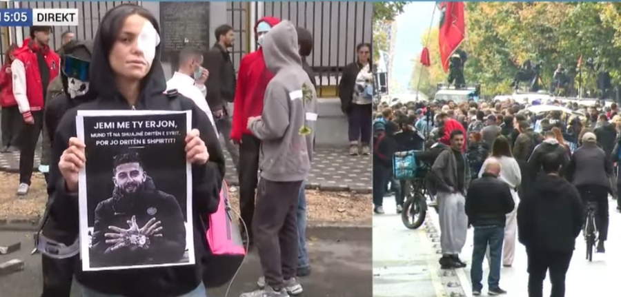 Të rinjtë fashojnë sytë në shenjë solidariteti me Erjon Vishkullin që u qëllua me plumb në sy
