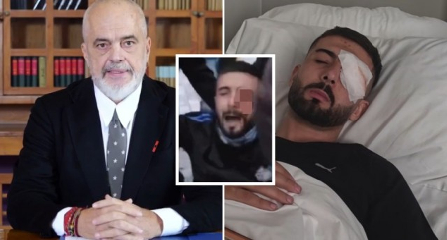 Motra e Erjonit demaskon propagandën e shëmtuar të trolleve të Ramës për kurimin  Janë të gjitha mashtrime nuk e ka dërguar shteti  por familja