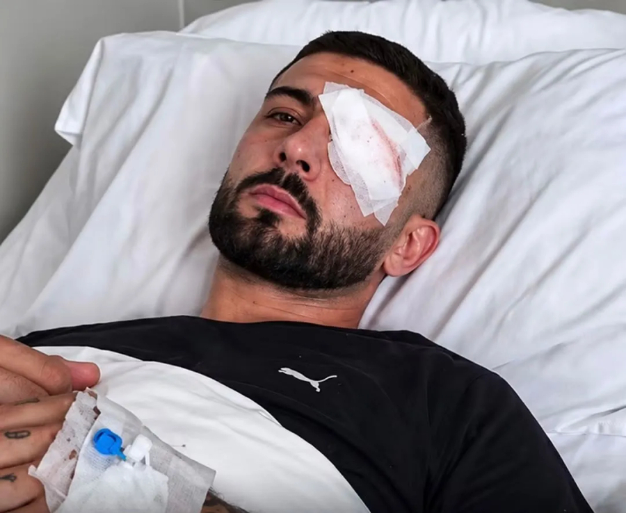 Policia e qëlloi me plumb në sy, i riu Erion Vishkulli mbërrin në Romë, futet në operacion sërish