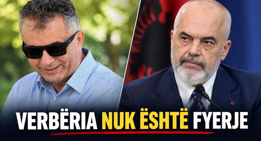  U bëfsh njëri prej nesh   i verbëri mesazh për Ramën  Nuk është mallkim  por bekim
