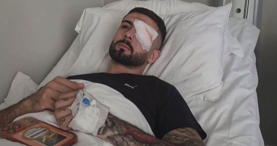  Nuk jam vetëm në këtë betejë   Erjon Vishkulli prek me mesazhin pas plagosjes në sy nga policia  Faleminderit shqiptarëve kudo në botë 
