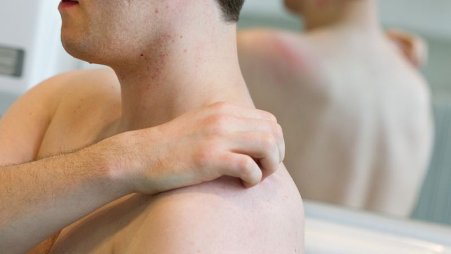  Kalbja e shiut    Një sëmundje shtazore që përhapet nëpër saunat e seksit në Evropë 