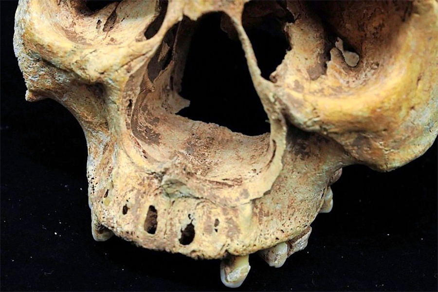 Grua pa hundë   Skeleti tregon ndëshkimin e tmerrshëm në Kinën mesjetare
